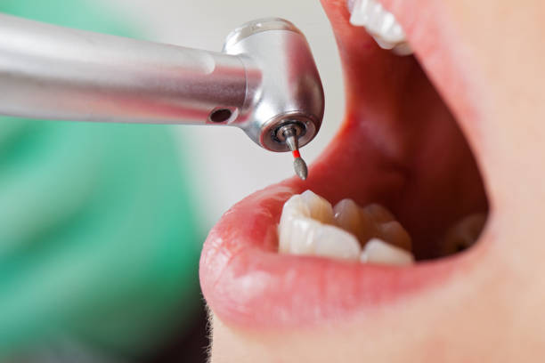 Best Emergency Root Canal Therapy in Harrison, NJ